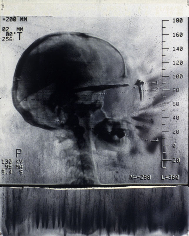 Albert Benamou, Aug. 3 1993. spray enamel, silk-screen on paper. 40 x 32 inches, 102 x 81.5 cm.