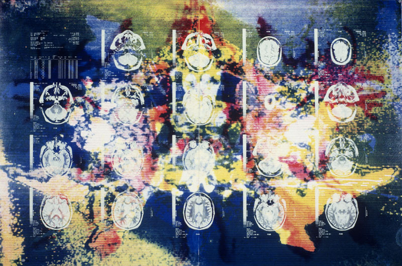 Dr. William Frosch, 1993. silk-screen on paper. 40 x 60 inches, 102 x 153 cm. 