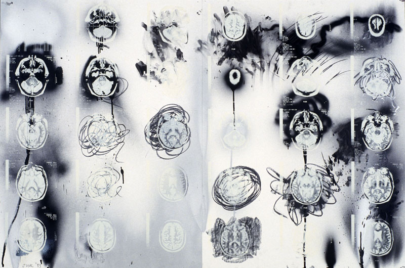 Dr. William Frosch, 1993. pencil, spray enamel, silk-screen on paper. 40 x 60 inches, 102 x 153 cm.