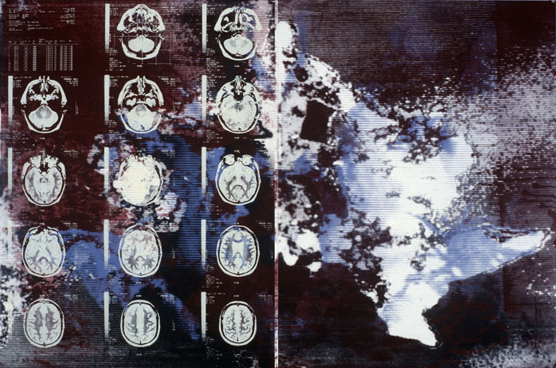 Dr. William Frosch, 1993. silk-screen on paper. 40 x 60 inches, 102 x 153 cm. 